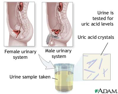 Uric acid test