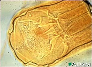 Hookworm - close-up of the organism