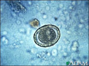 Roundworm eggs - ascariasis