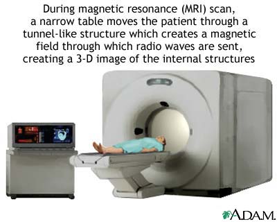 MRI scans