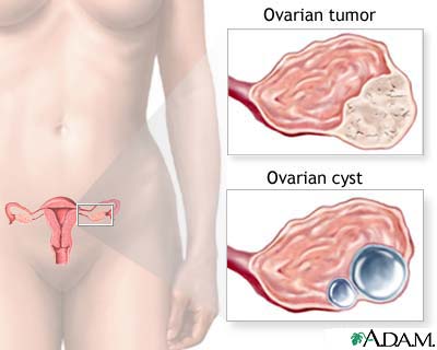 Ovarian growth worries