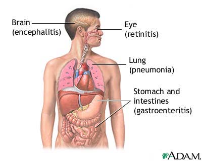 CMV (cytomegalovirus)