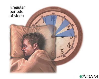 Irregular sleep