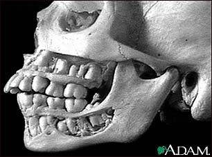 Teeth, adult - in the skull