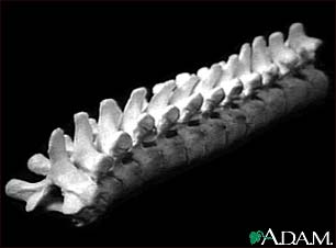 Vertebra, thoracic (mid back)