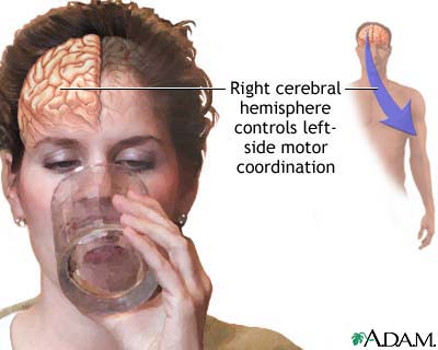 Right cerebral hemisphere - function