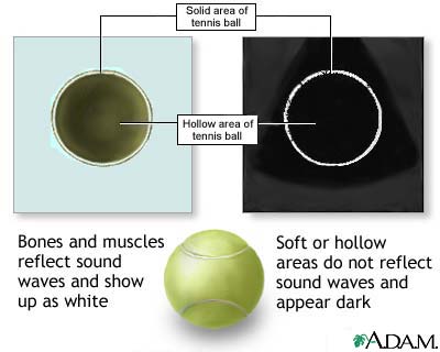 Ultrasound comparison