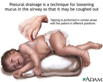 Postural drainage