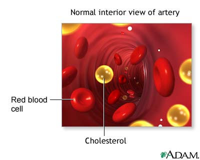 Cholesterol