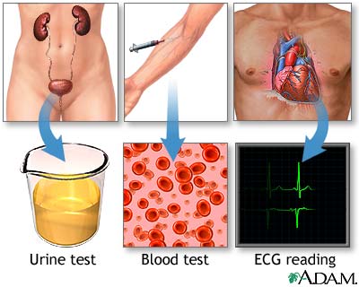 High blood pressure tests