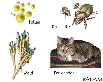 Common asthma triggers