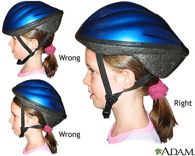 Bicycle helmet - proper usage