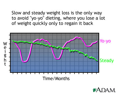 Yo-yo dieting