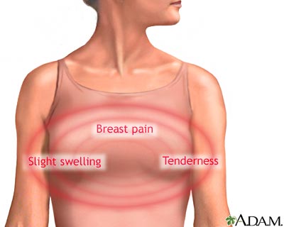 Breast pain