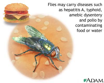 Hepatitis A