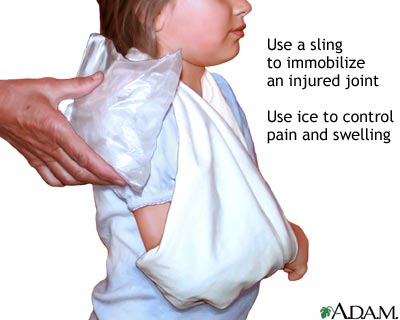 Triangular shoulder sling